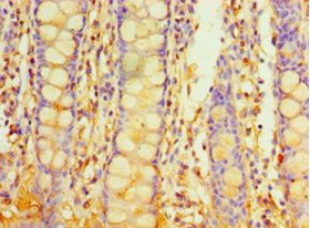 Immunohistochemistry of paraffin-embedded human rectum tissue using PIGX Polyclonal Antibody at dilution 1:100