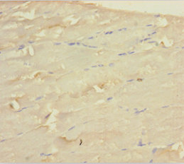 WDR77 Polyclonal Antibody