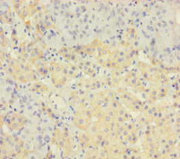 TAF12 Polyclonal Antibody
