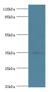 DIMT1 Polyclonal Antibody