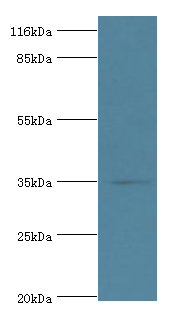 DIMT1 Polyclonal Antibody (100 µl)