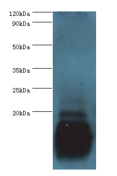 PVALB Polyclonal Antibody
