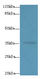 DNAJB2 Polyclonal Antibody