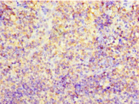 CD2 Polyclonal Antibody