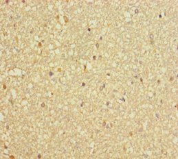 DCTN3 Polyclonal Antibody