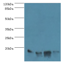 LGALS1 Polyclonal Antibody