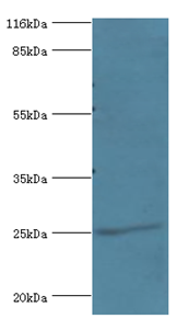 DGCR6L Polyclonal Antibody
