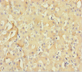 CNKSR2 Polyclonal Antibody