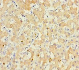 RS1 Polyclonal Antibody