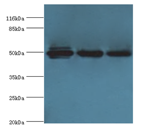 KRT38 Polyclonal Antibody