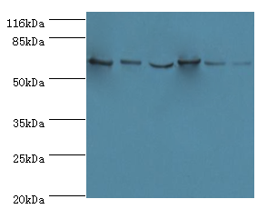 LCP1 Polyclonal Antibody