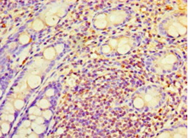 RAB6A Polyclonal Antibody