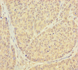 PSMF1 Polyclonal Antibody
