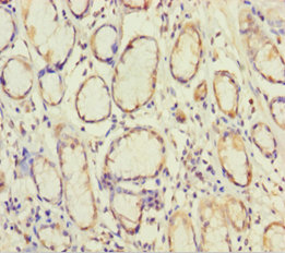 GRP Polyclonal Antibody