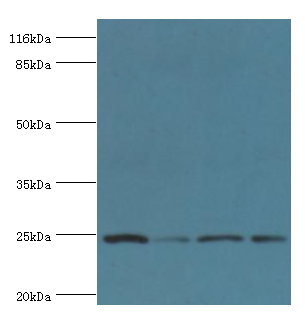 GSTK1 Polyclonal Antibody