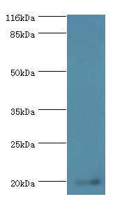 MPV17 Polyclonal Antibody