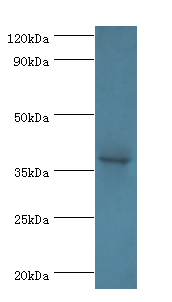 ATP6AP2 Polyclonal Antibody
