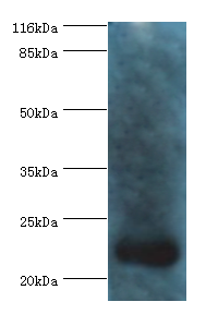 RCVRN Polyclonal Antibody