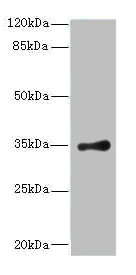 Western blot<br />All lanes: RPLP0 Polyclonal Antibody at 8ug/ml+ Rat brain tissue<br />Goat polyclonal to rabbit at 1/10000 dilution<br />Predicted band size: 35, 28 kDa<br />Observed band size: 34 kDa<br />