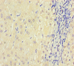 DGUOK Polyclonal Antibody