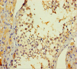 PARK2 Polyclonal Antibody