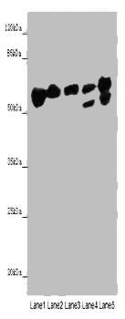 ALDH5A1 Polyclonal Antibody