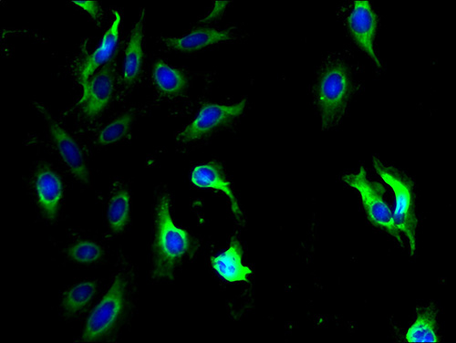 QPCTL Polyclonal Antibody