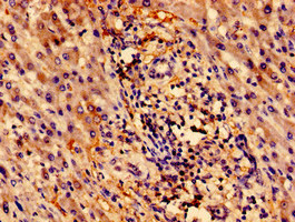 ZNF155 Polyclonal Antibody
