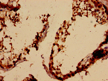 ALKBH3 Polyclonal Antibody