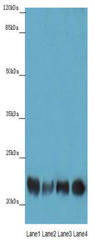 ABHD14B Polyclonal Antibody