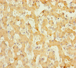 Immunohistochemistry of paraffin-embedded human liver tissue using ABHD14B Polyclonal Antibody at dilution 1:100