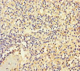 ITGA2B Polyclonal Antibody