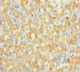 OTC Polyclonal Antibody