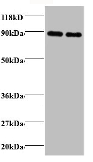Transferrin Polyclonal Antibody