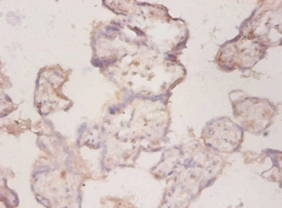 CP Polyclonal Antibody