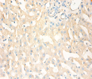 MT1X Polyclonal Antibody