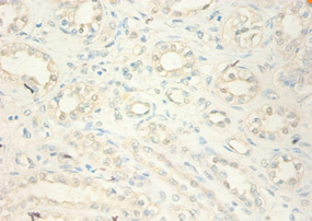 MT2A Polyclonal Antibody