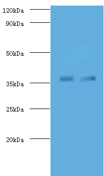 fbpA Polyclonal Antibody