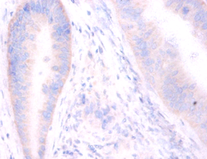 STX6 Polyclonal Antibody