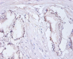RPA3 Polyclonal Antibody