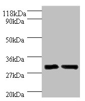 IL-33 Polyclonal Antibody (100 µl)