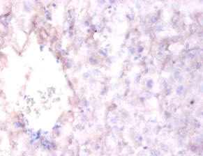 RELN Polyclonal Antibody