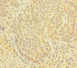 GLRX Polyclonal Antibody