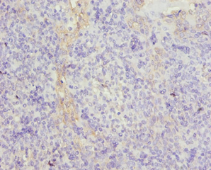 Tubulin Beta Chain A Polyclonal Antibody