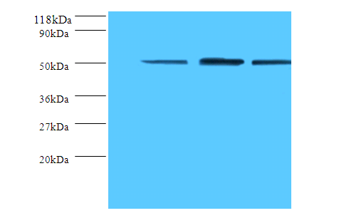 Tubulin Beta Chain A Polyclonal Antibody