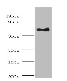 ANGPT1 Polyclonal Antibody (100 µl)