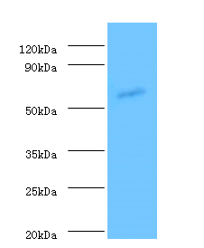 ANGPT1 Polyclonal Antibody