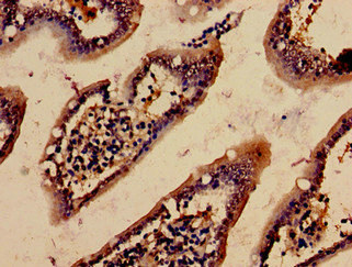 Actin, Cytoplasmic 1 Polyclonal Antibody (100 µl)