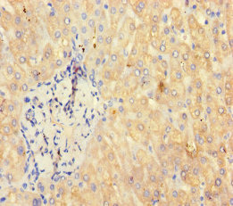 Immunohistochemistry of paraffin-embedded human liver tissue using RBMY1A1 Polyclonal Antibody at dilution of 1:100.