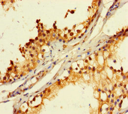 Immunohistochemistry of paraffin-embedded human  testis tissue using RBMY1A1 Polyclonal Antibody at dilution of 1:100.